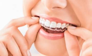 Woman putting in her Invisalign tray